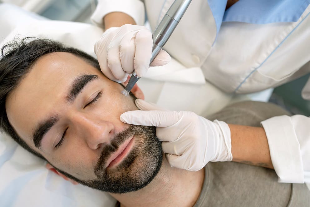 Top 5 Skin Treatments for Men in 2023